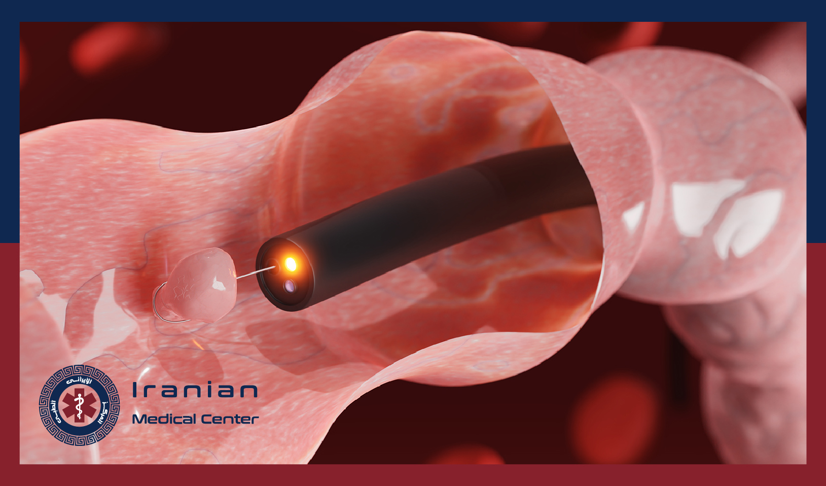 Endoscopy: Techniques, Benefits, and Its Importance in Medical Diagnosis in Qatar